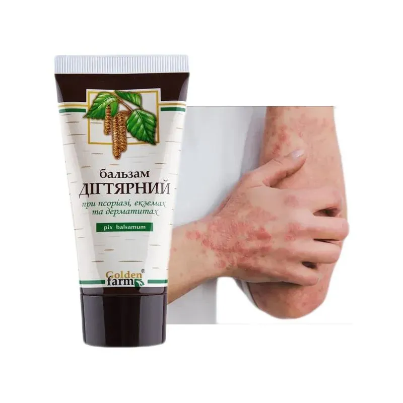 Jak wybrać maść AZS